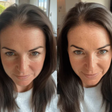 Revitalize Your Hair, Revive Your Confidence!