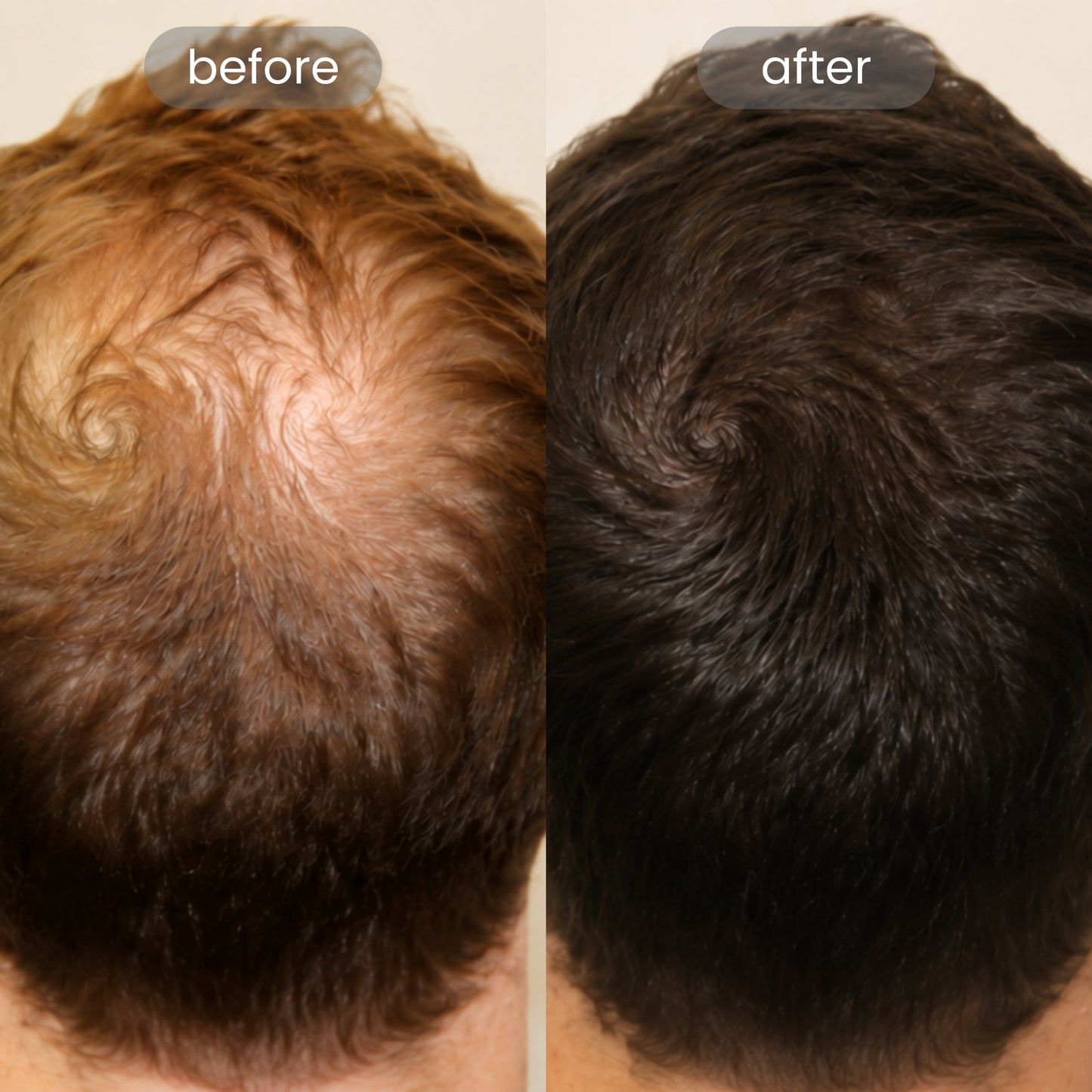 Peptide Hair Growth Serum