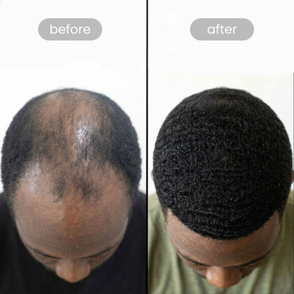 Peptide Hair Growth Serum