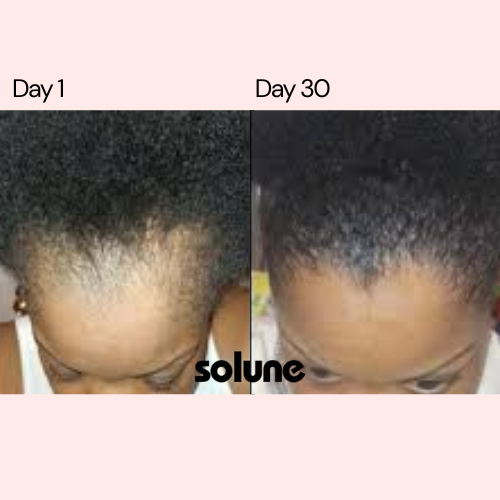 solune - RedVive Brush